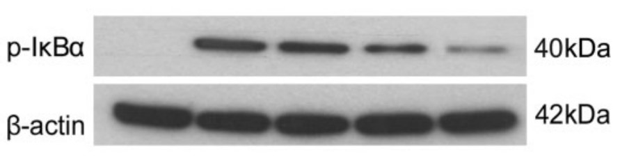 rCC16 inhibits LPS-induced phosphorylation of IκBα in RTE cells.jpg